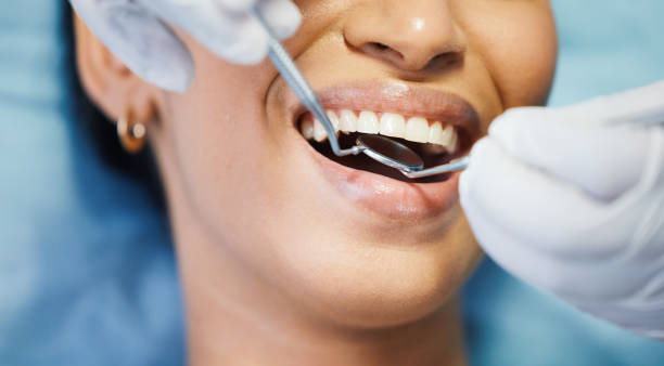Best Emergency Denture Repair in King Arthur Park, MT
